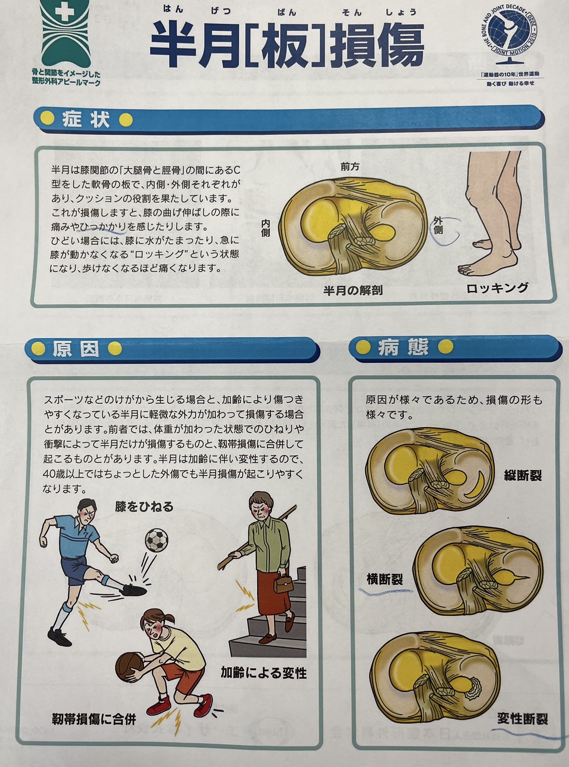 その後の社長の左膝