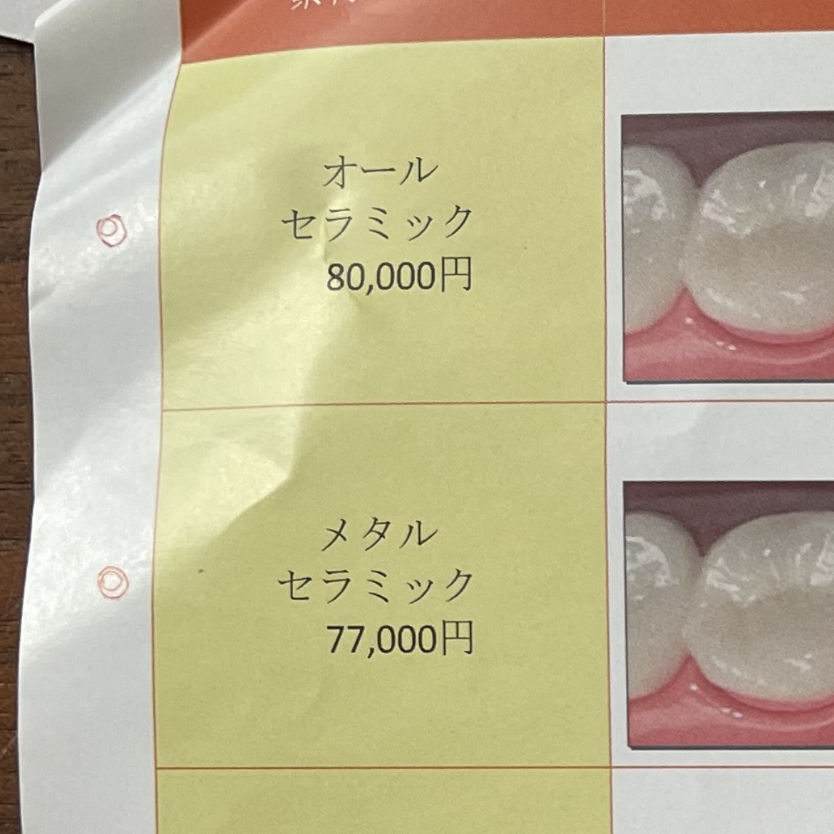 えらいことになった…